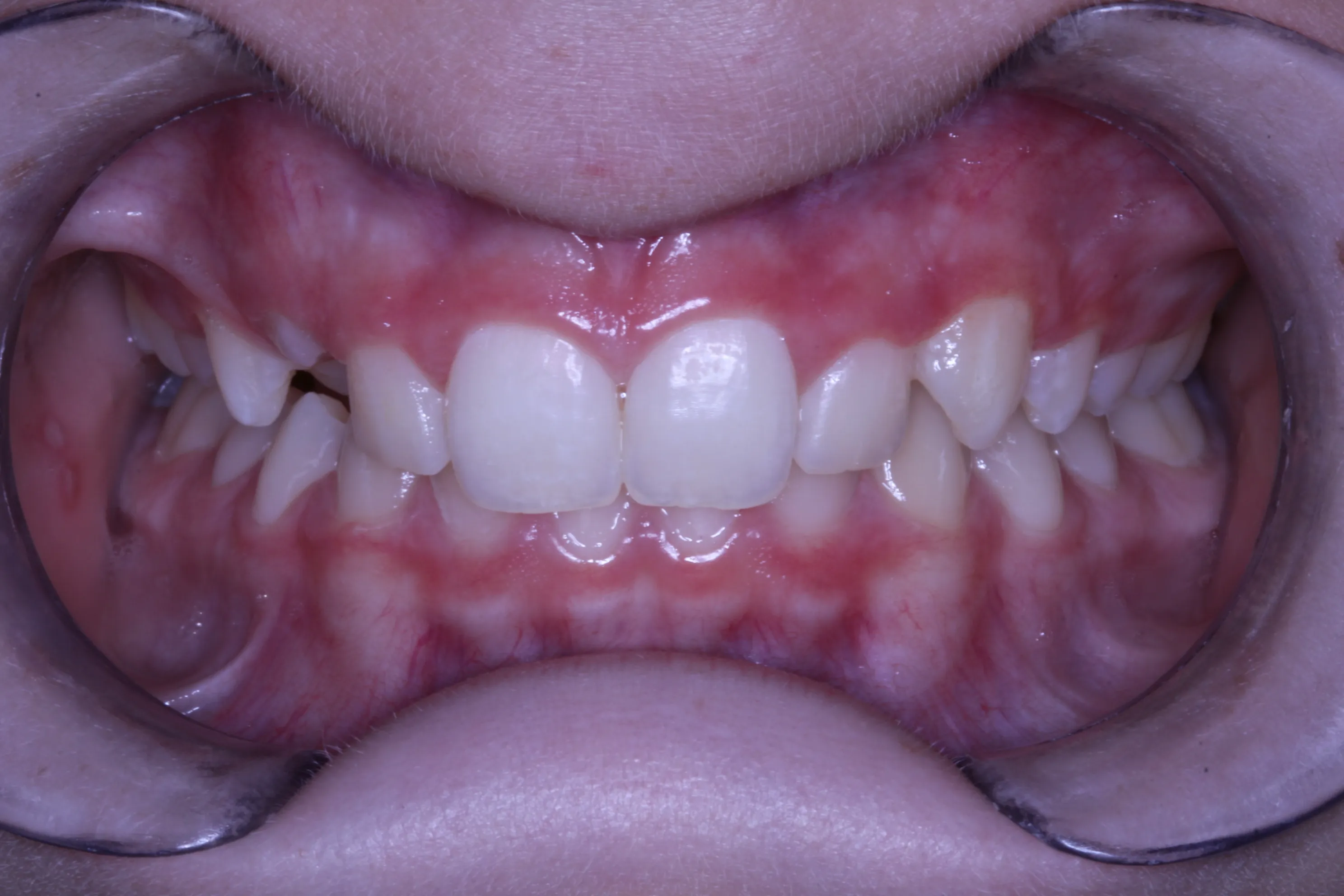 smile-gallery gallery